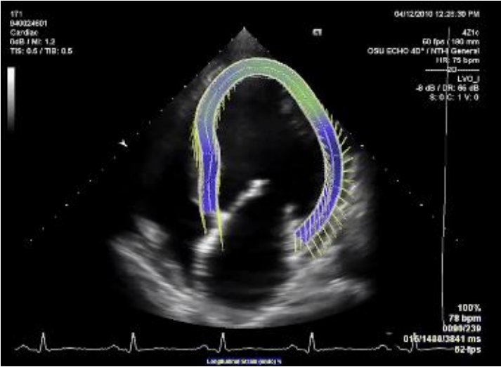 ”cachorrodançando”